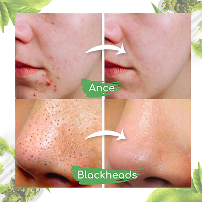 Juxek™ Green Tea Clay Mask Stick For Oil Control, Blackhead Reduction, and Pore Minimization