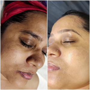 （🔥LAST DAY SALE-80% OFF)Fast Dark Spot Remover-AQA™ Melanin Correcting Facial Serum
