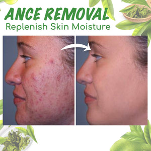 Juxek™ Green Tea Clay Mask Stick For Oil Control, Blackhead Reduction, and Pore Minimization